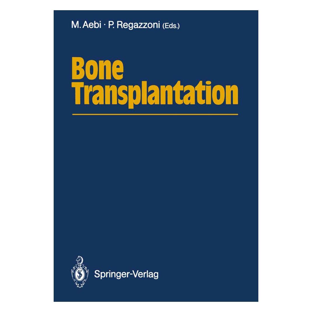 Springer Bone Transplantation (Englisch, Softcover, Max Aebi, Pietro Regazzoni) (55506320)