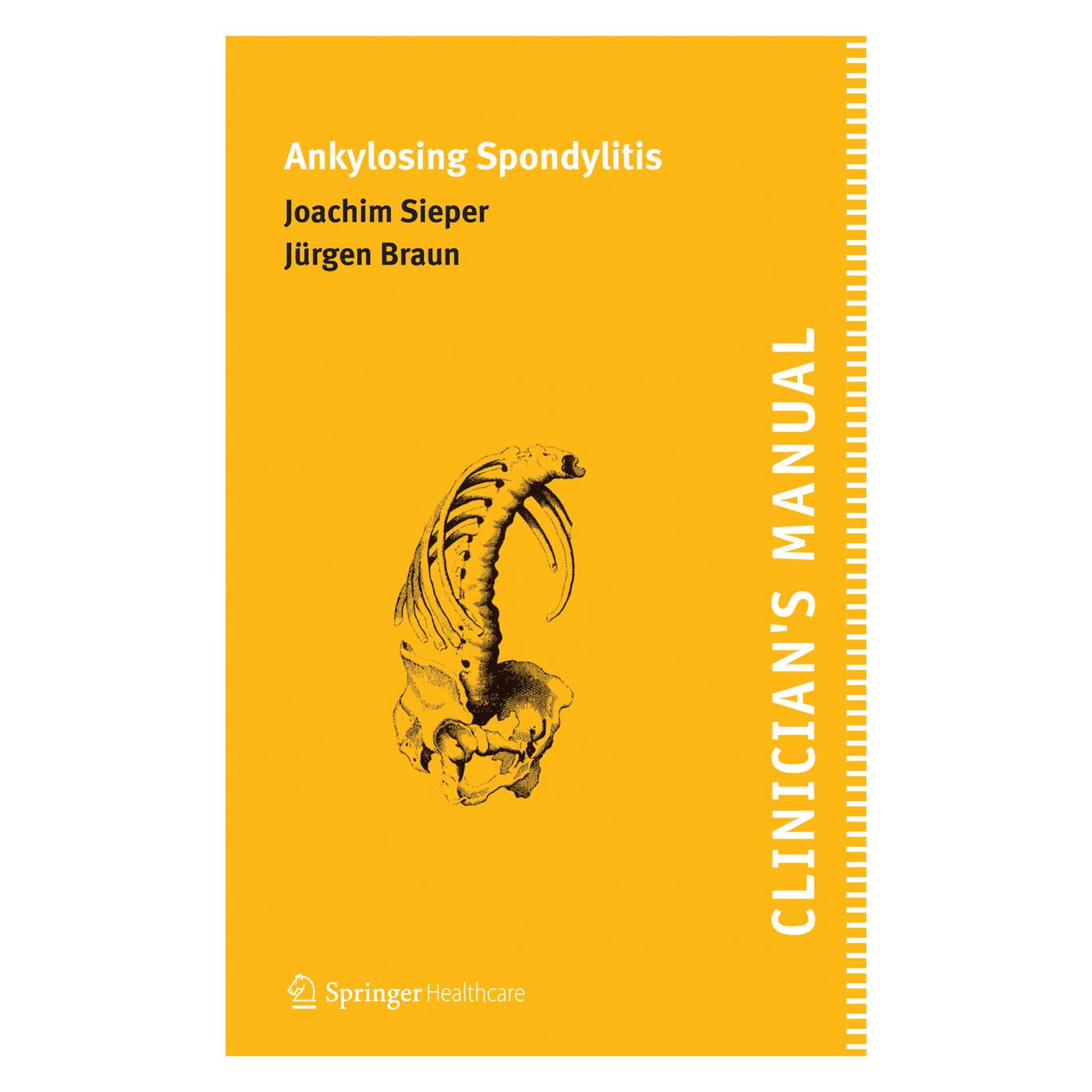 Springer Clinician's Manual on Ankylosing Spondylitis (Englisch, Softcover, Joachim Sieper, Jürgen Braun) (9620239)