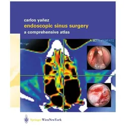 Endoscopic Sinus Surgery, Fachbücher von Carlos Yañez
