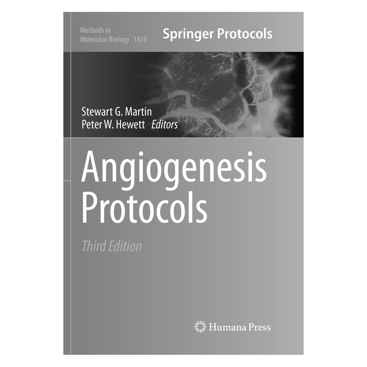 Springer Angiogenesis Protocols (Englisch, Softcover, Peter W. Hewett, Stewart G. Martin) (56001211)