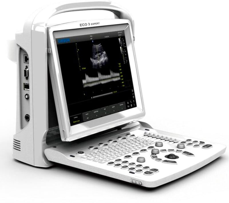Ecógrafo portátil Chison ECO3 Expert