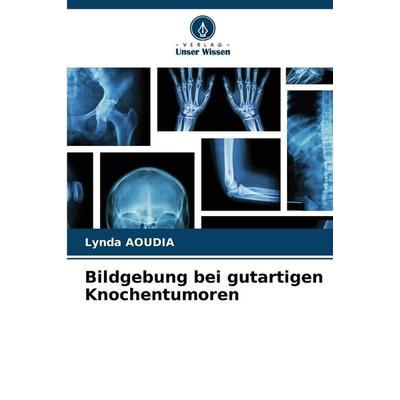 Bildgebung bei gutartigen Knochentumoren, Taschenbuch von Lynda Aoudia, Verlag Unser Wissen, 978-620-7-40102-4
