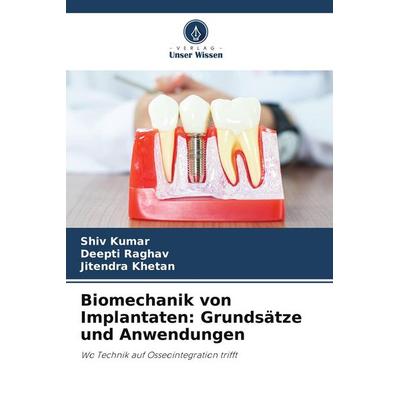 Biomechanik von Implantaten: Grundsätze und Anwendungen, Taschenbuch von Shiv Kumar,Deepti Raghav,Jitendra Khetan, Verlag Unser Wissen,