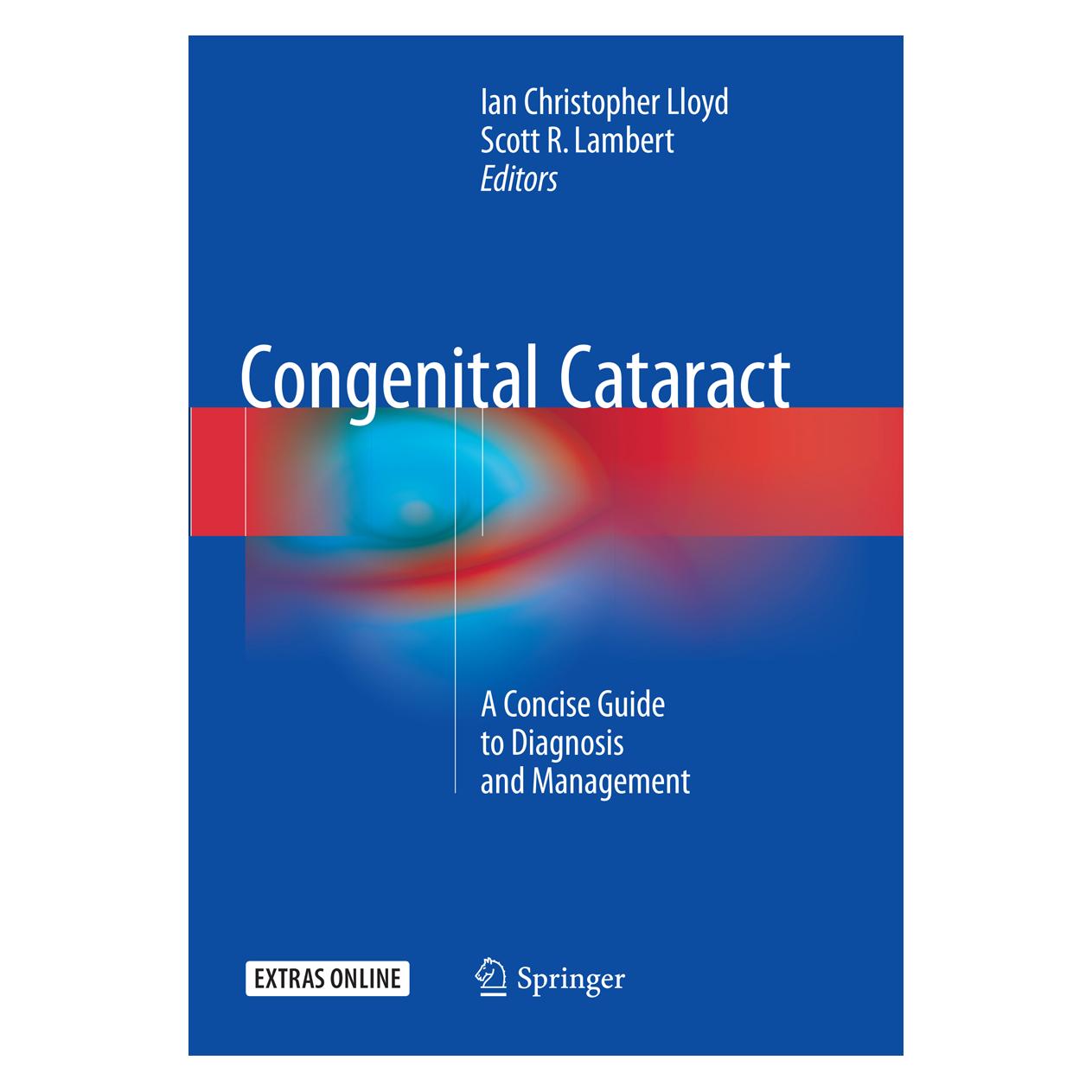 Springer Congenital Cataract (Englisch, Softcover, Ian Christopher Lloyd, Scott R. Lambert) (55998207)