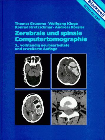 Thomas Grumme - Zerebrale und spinale Computertomographie - Preis vom 09.10.2026 07:28:09 h