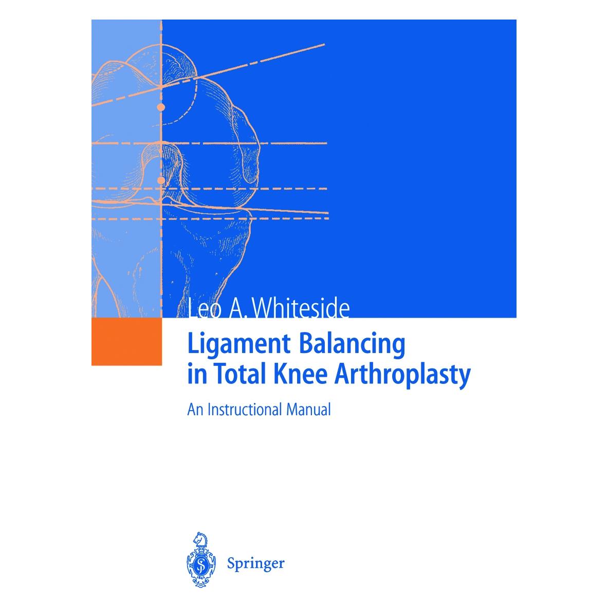 Springer Ligament Balancing in Total Knee Arthroplasty (Englisch, Softcover, Leo A. Whiteside) (55505044)
