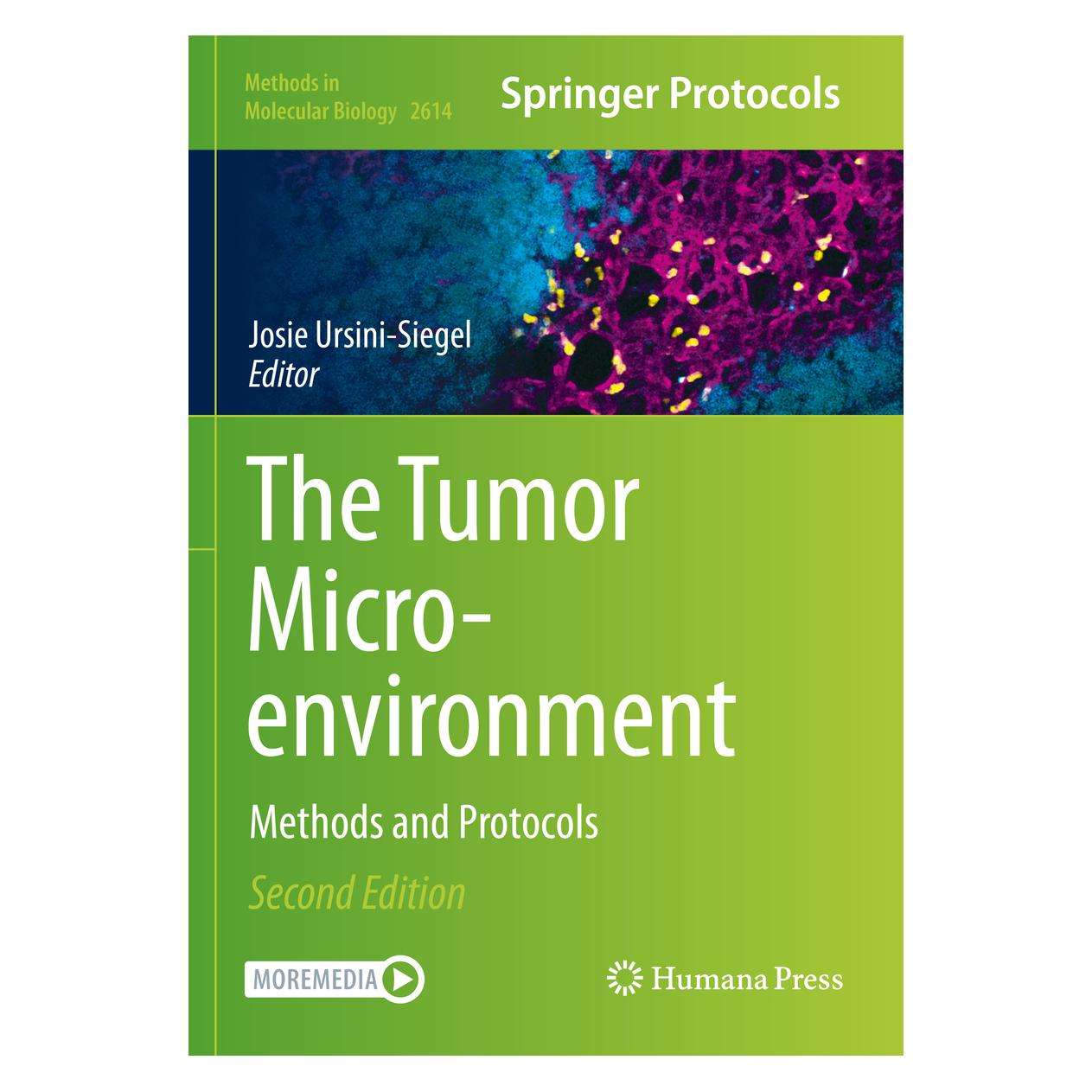 Springer The Tumor Microenvironment (Englisch, Softcover, Josie Ursini-Siegel) (56991464)