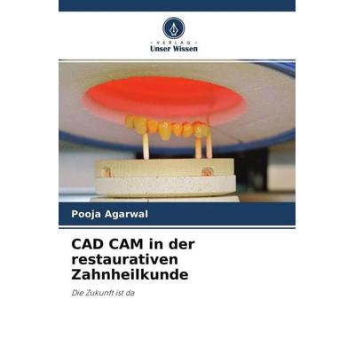 Agarwal, P: CAD CAM in der restaurativen Zahnheilkunde, Taschenbuch von Pooja Agarwal, Verlag Unser Wissen, 978-620-4-14325-5