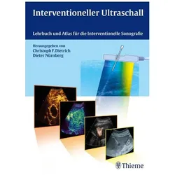 Interventioneller Ultraschall, Fachbücher von Dieter Nürnberg, Christoph Frank Dietrich