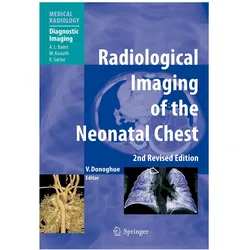 Radiological Imaging of the Neonatal Chest, Fachbücher von Veronica B. Donoghue