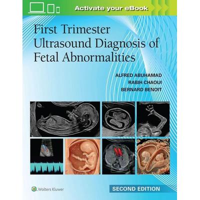 First Trimester Ultrasound Diagnosis of Fetal Abnormalities, Gebundene Ausgabe von Alfred Z. Abuhamad,Rabih Chaoui,Bernard Benoit, Lippincott