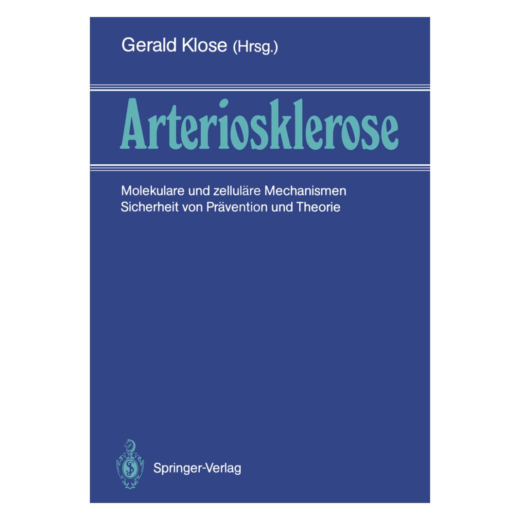 Springer Arteriosklerose (Deutsch, Softcover, Gerald Klose) (55507913)