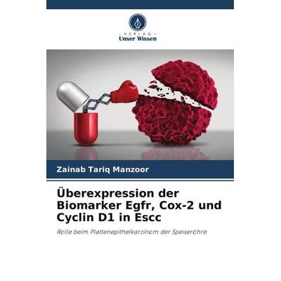 Tariq Manzoor, Z: Überexpression der Biomarker Egfr, Cox-2 u, Taschenbuch von Zainab Tariq Manzoor, Verlag Unser Wissen, 978-620-5-37006-3