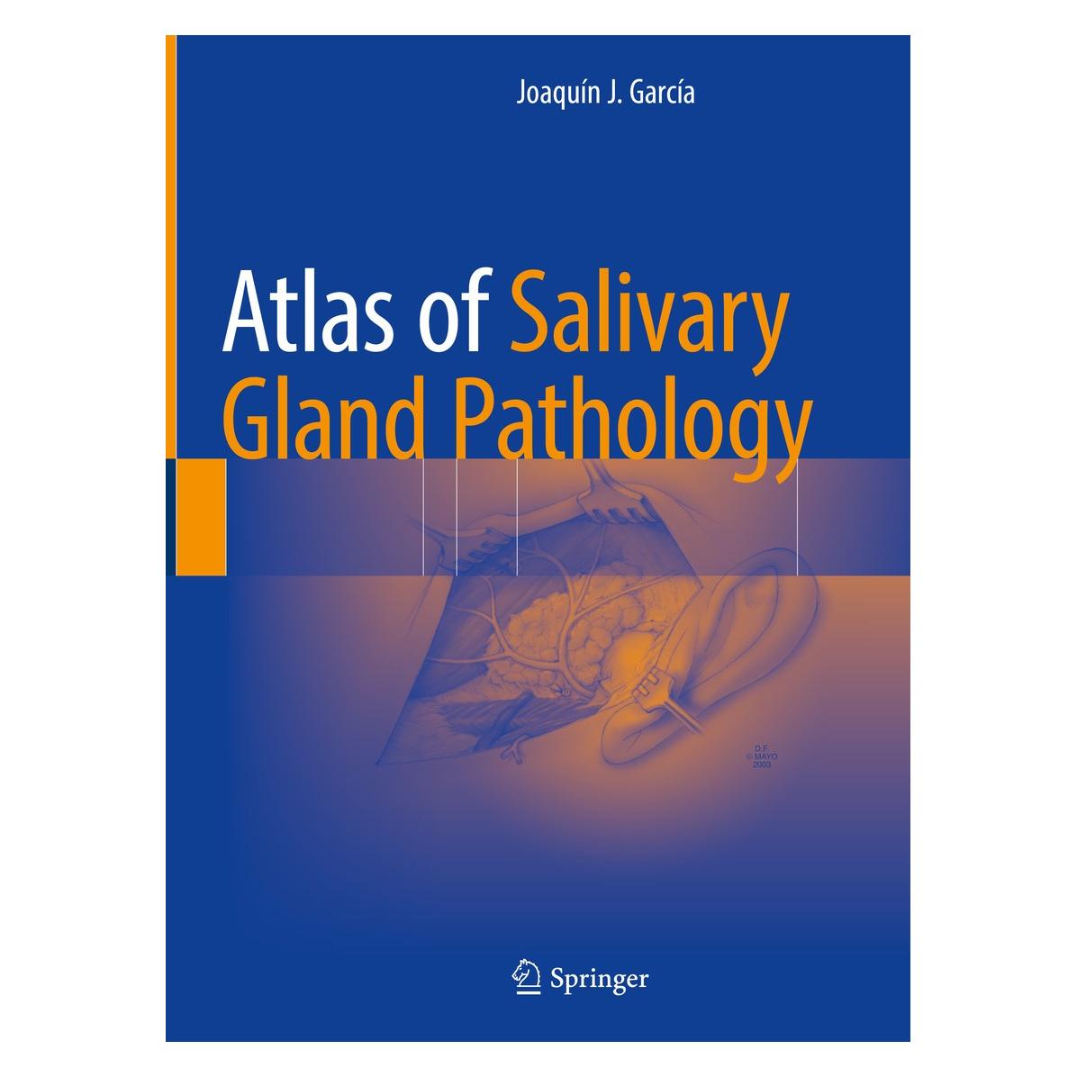 Springer Atlas of Salivary Gland Pathology (Englisch, Hardcover, Joaquín J. García) (9783319090207)