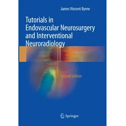 Tutorials in Endovascular Neurosurgery and Interventional Neuroradiology, Fachbücher von James Vincent Byrne