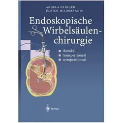 Endoskopische Wirbelsäulenchirurgie, Fachbücher von Angela Olinger, Ulrich Hildebrandt