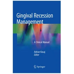 Gingival Recession Management, Fachbücher von Adrian Kasaj