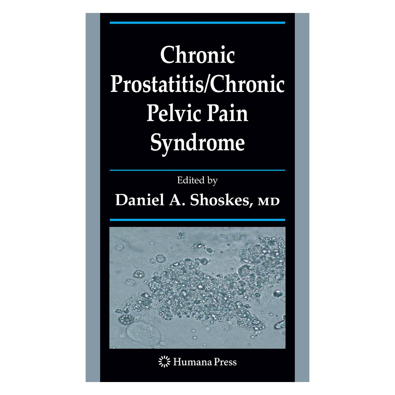 Springer Chronic Prostatitis/Chronic Pelvic Pain Syndrome (Englisch, Softcover, Daniel A. Shoskes) (55383196)