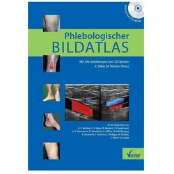 Phlebologischer Bildatlas, Fachbücher von Eberhard Rabe, Markus Stücker