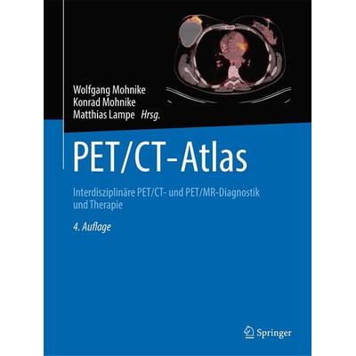 PET/CT-Atlas, Gebundene Ausgabe von , Springer Berlin, 978-3-662-67191-7