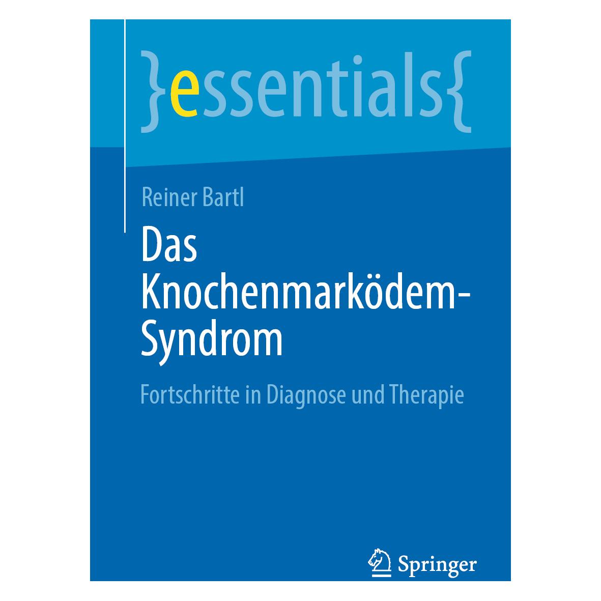 Springer Bartl:Het beenmergoedeemsyndroom (Deutsch, Softcover, Reiner Bartl) (45949249)
