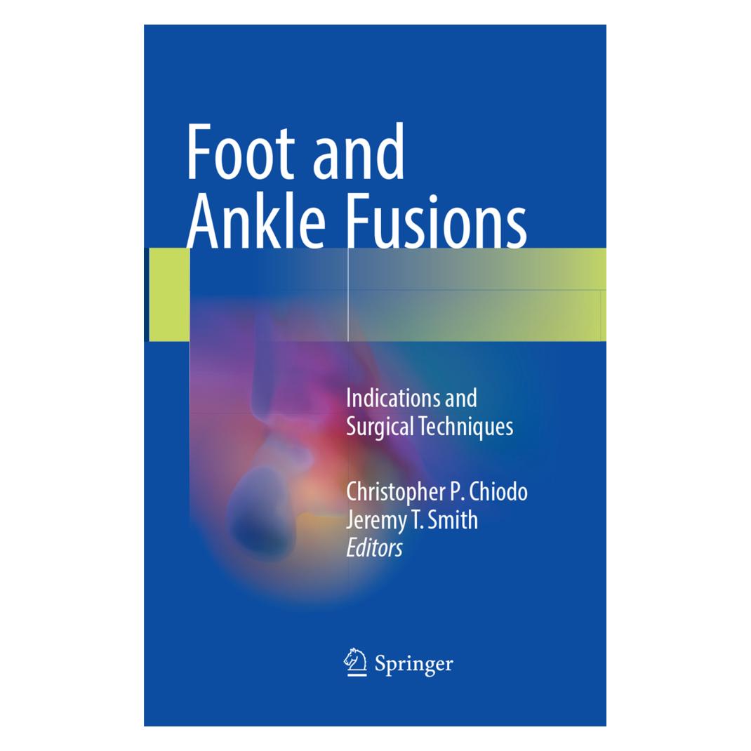 Springer Foot and Ankle Fusions (Englisch, Softcover, Christopher P. Chiodo, Jeremy T. Smith) (56051675)