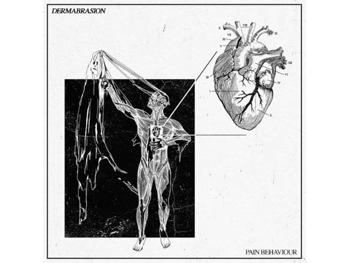 Pain Behaviour