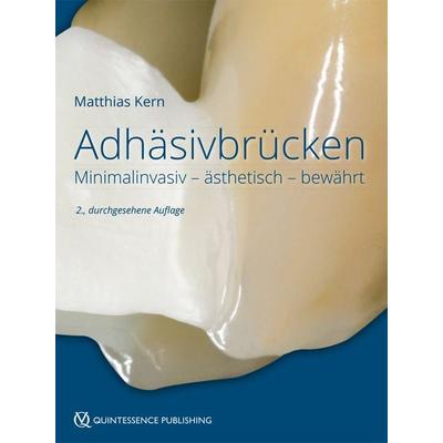 Adhäsivbrücken, Gebundene Ausgabe von Matthias Kern, Quintessenz Verlag, 978-3-86867-412-5