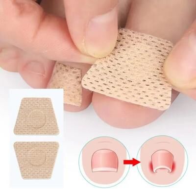Healfit Counter Nail Art Foot Patches Feet Care, Ingrown Toenail Toe Correction Stickers, Paronychia Treatment Recover Pedicure Tool 20pcs