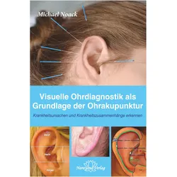 Ohrakupunktur Visuelle Diagnostik des Ohres, Ratgeber von Michael Noack