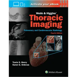 Webb & Higgins Thoracic Imaging: Print + eBook with Multimedia, Fachbücher von Travis Scott Henry, KAREN GOMES ORDOVAS