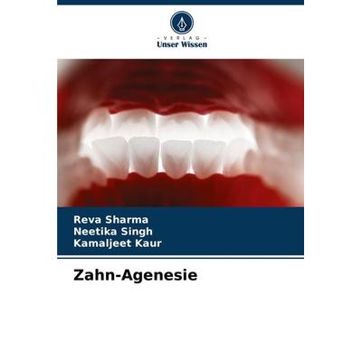 Zahn-Agenesie, Taschenbuch von Reva Sharma,Neetika Singh,Kamaljeet Kaur, Verlag Unser Wissen, 978-620-7-75792-3