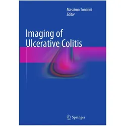 Imaging of Ulcerative Colitis, Fachbücher von Massimo Tonolini