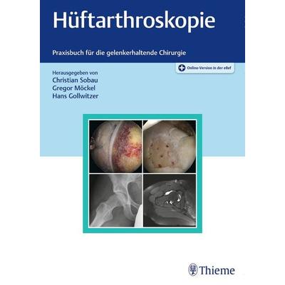 Hüftarthroskopie, Gebundene Ausgabe von , Thieme, 978-3-13-242215-5