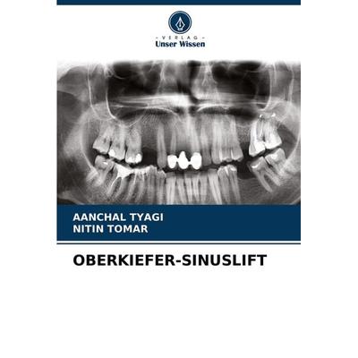 Oberkiefer-Sinuslift, Taschenbuch von Aanchal Tyagi,Nitin Tomar, Verlag Unser Wissen, 978-620-4-22630-9