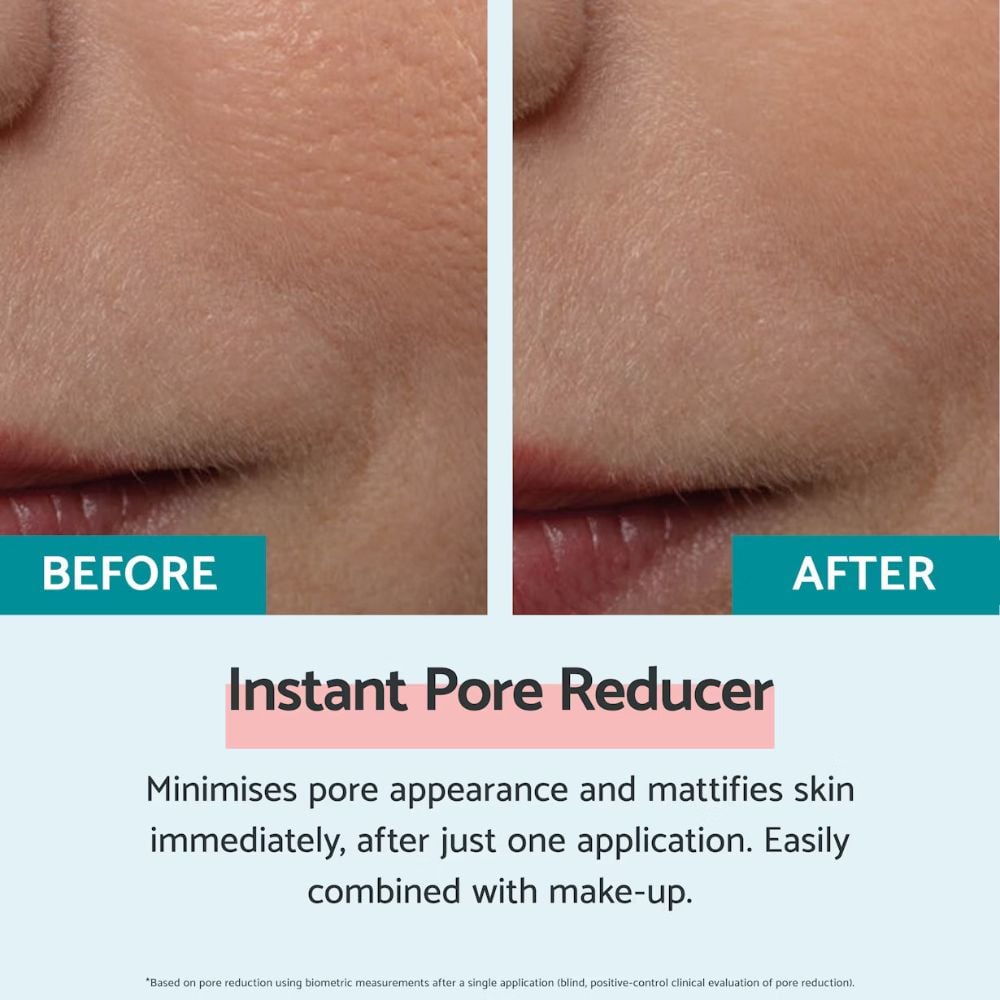 Remescar Instant Pore Reducer Skin Perfector 20mL