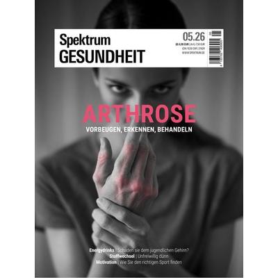 Spektrum Gesundheit 5/2026 - Arthrose, Taschenbuch von , Spektrum der Wissenschaft, 978-3-690-41054-0