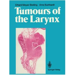 Tumours of the Larynx, Fachbücher von Erhard Meyer-Breiting, Arne Burkhardt