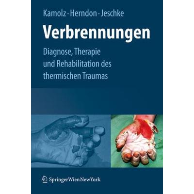 Verbrennungen, Gebundene Ausgabe von Lars-Peter Kamolz,David N. Herndon,Marc G. Jeschke, Springer Wien, 978-3-211-79895-9