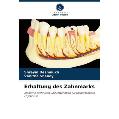 Erhaltung des Zahnmarks, Taschenbuch von Shreyal Deshmukh,Vanitha Shenoy, Verlag Unser Wissen, 978-620-6-76298-0