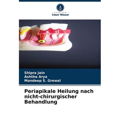 Periapikale Heilung nach nicht-chirurgischer Behandlung, Taschenbuch von Shipra Jain,Ashtha Arya,Mandeep S. Grewal, Verlag Unser Wissen,