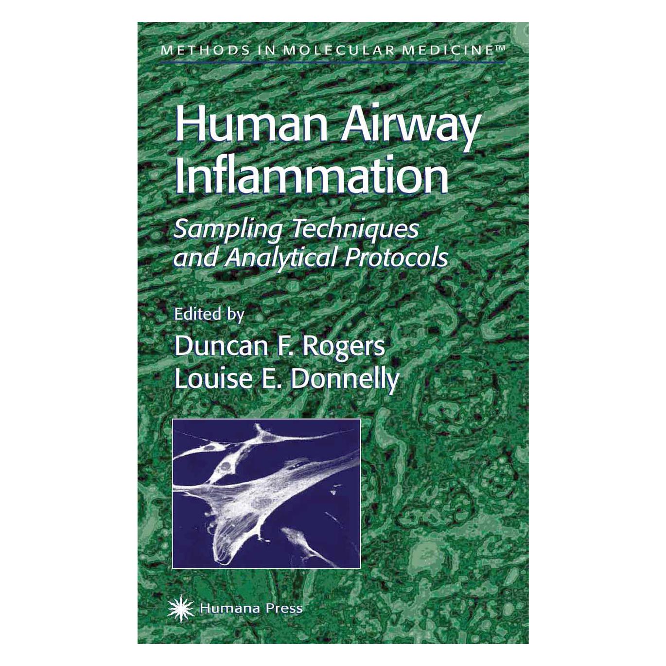 Springer Human Airway Inflammation (Englisch, Softcover, E Donnelly Louise, Rogers Duncan) (55560587)