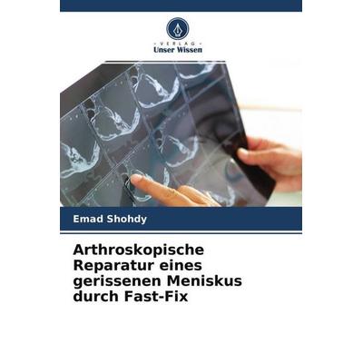Arthroskopische Reparatur eines gerissenen Meniskus durch Fast-Fix, Taschenbuch von Emad Shohdy, Verlag Unser Wissen, 978-620-4-70335-0