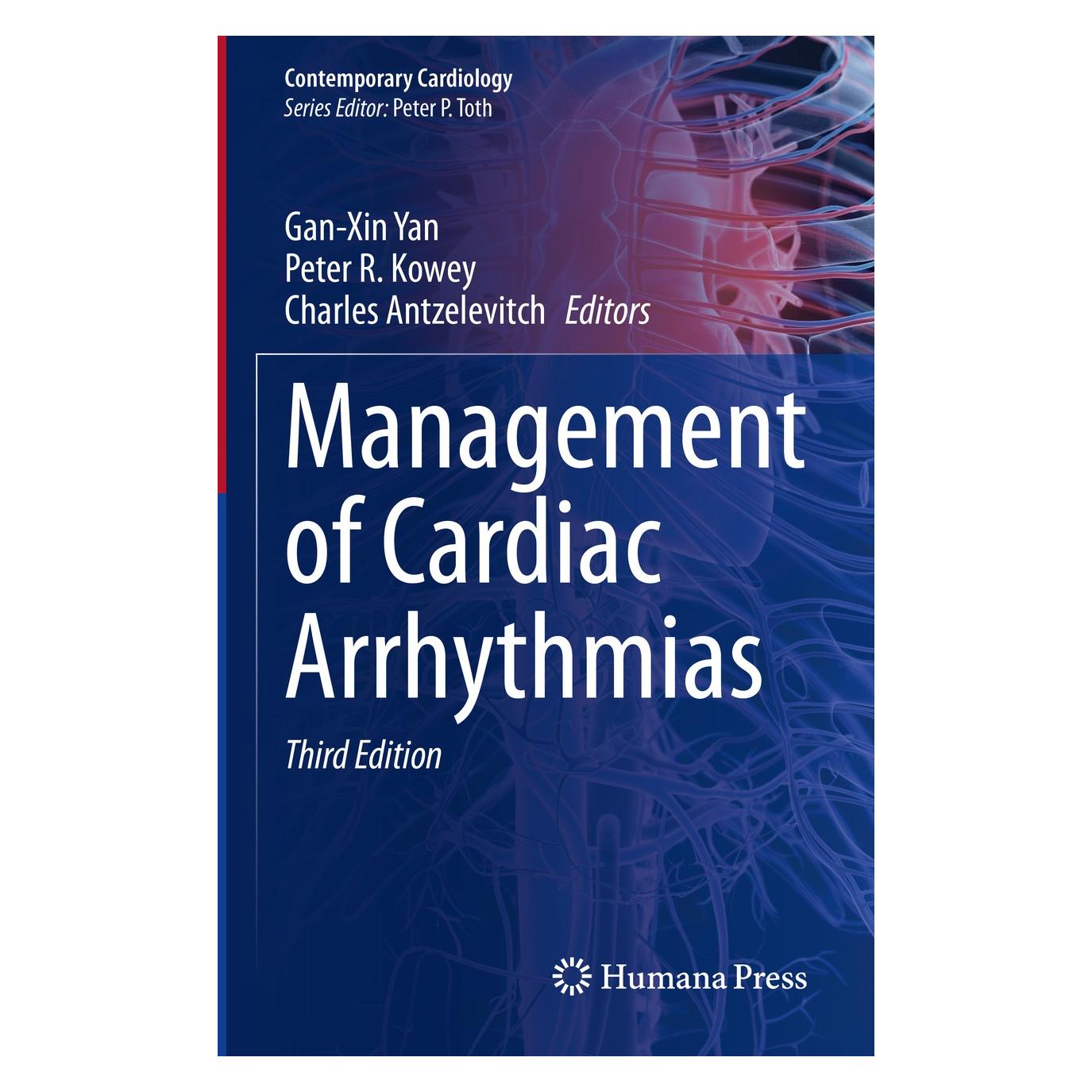 Springer Management of Cardiac Arrhythmias (Englisch, Hardcover, Charles Antzelevitch, Gan-Xin Yan, Peter R. Kowey) (9783030419660)