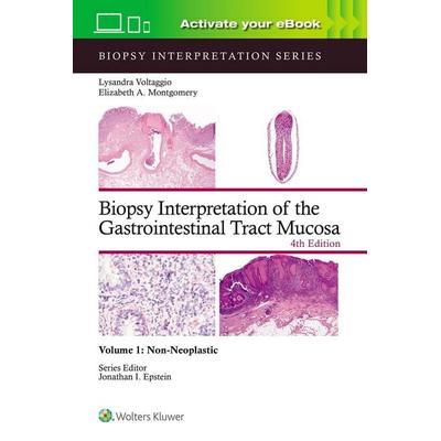 Biopsy Interpretation of the Gastrointestinal Tract Mucosa Volume 1, Gebundene Ausgabe von Lysandra Voltaggio,Elizabeth Anne Montgomery, Lippincott