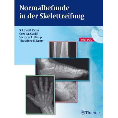 Normalbefunde in der Skelettreifung, Gebundene Ausgabe von S. Lowell Kahn,Cree M. Gaskin,Victoria L. Sharp,Theodore E. Keats, Thieme,