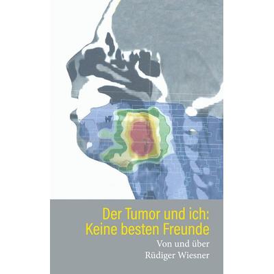 Der Tumor und Ich: Keine besten Freunde, Taschenbuch von Rüdiger Wiesner, BoD – Books on Demand, 978-3-7543-0344-3