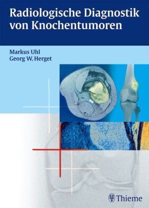 Markus Uhl - Radiologische Diagnostik von Knochentumoren - Preis vom 12.10.2026 11:37:12 h
