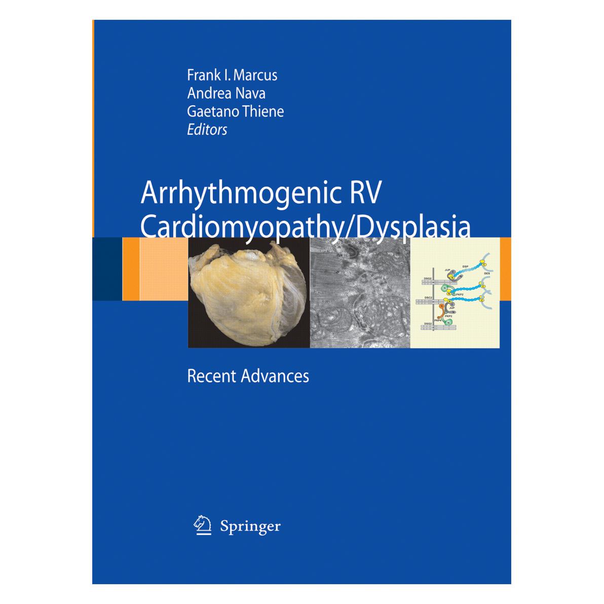 Springer Arrhythmogenic RV Cardiomyopathy/Dysplasia (Englisch, Softcover, Andrea Nava, Frank I. Marcus, Gaetano Thiene) (55579701)