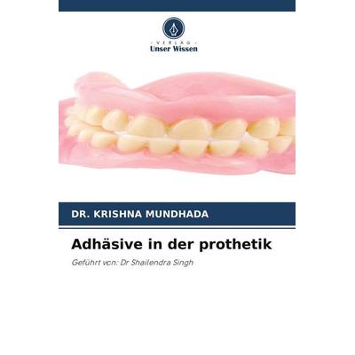Adhäsive in der prothetik, Taschenbuch von Krishna Mundhada, Verlag Unser Wissen, 978-620-9-62365-3